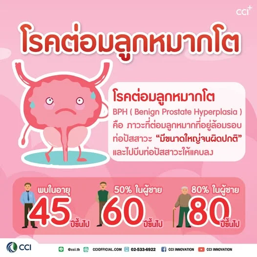 ผู้ชายต้องรู้! "โรคต่อมลูกหมากโต" เรื่องสำคัญที่ยิ่งอายุมาก ยิ่งเลี่ยงยาก 👨‍⚕️📈